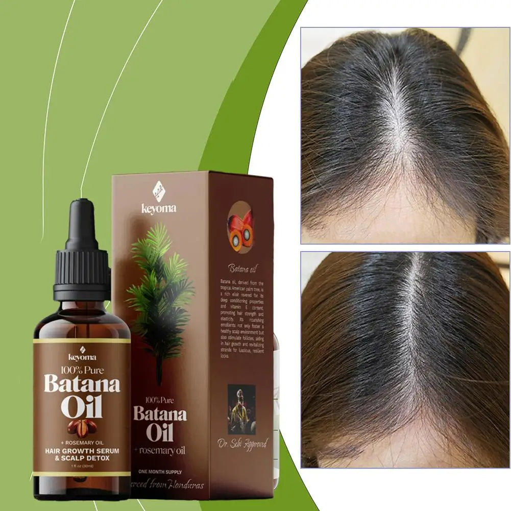 Batana Rosemary Mint Scalp Hair Strengthening Oil Nourishing Treatment Split Ends Anti Hair Loss Essence Dry Essential Oils